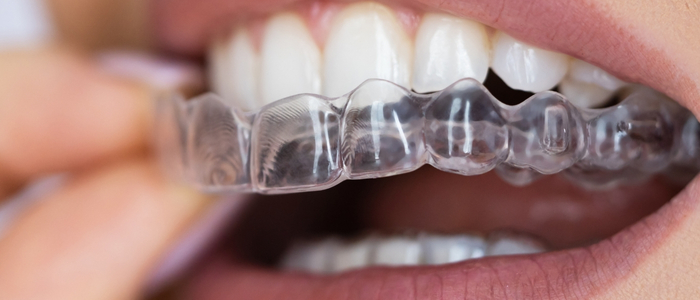 Swetha Multispeciality Dental Hospital