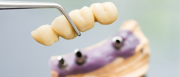 Swetha Multispeciality Dental Hospital