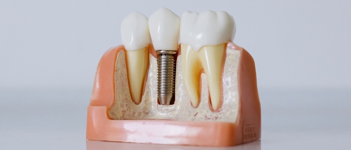 Swetha Multispeciality Dental Hospital